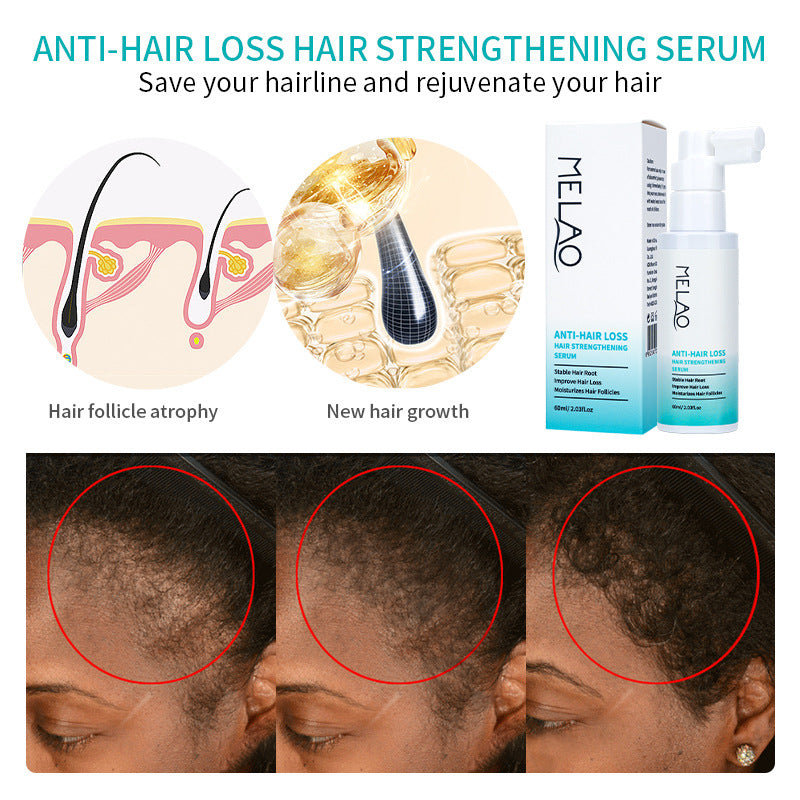 Growing Hair Growth Liquid Scalp Care Tough