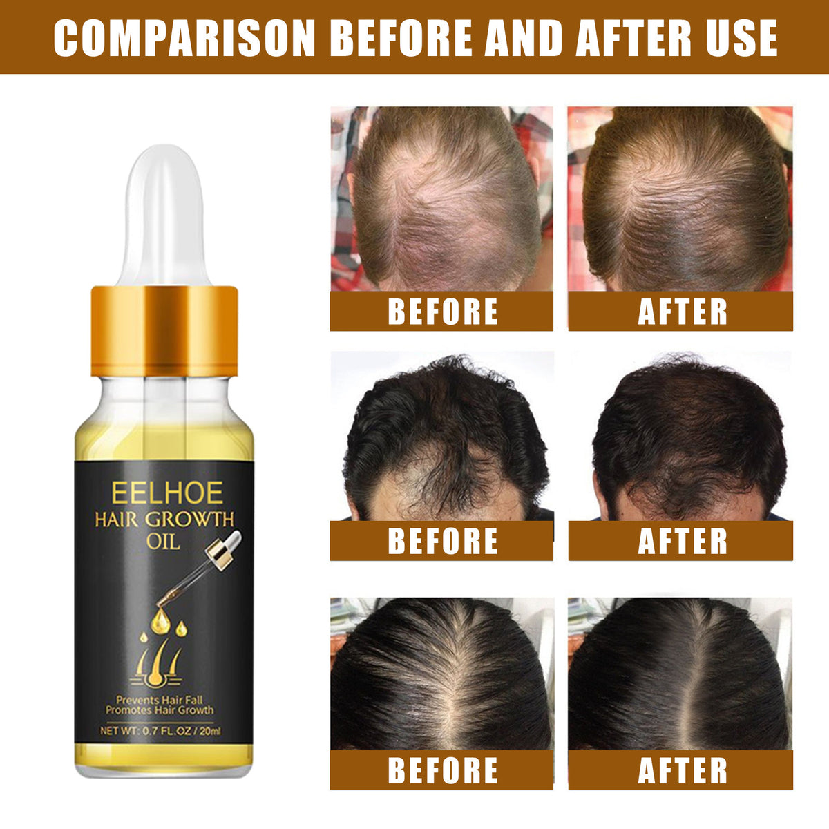 Hair Growth Essential Oil  Care Essential Nutrient Liquid