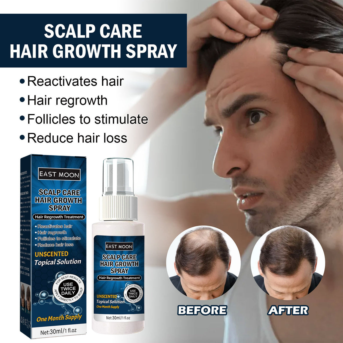 Men's Hair Growth Spray Anti-drop Care